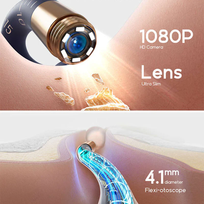 Gentle Ear Care with Safety and Full Control – AurixVue - Image 4