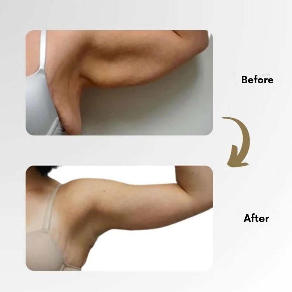 LymphMag™ Ring — Ignite Your Fat-Burning Power and Unleash Explosive Energy - Image 10