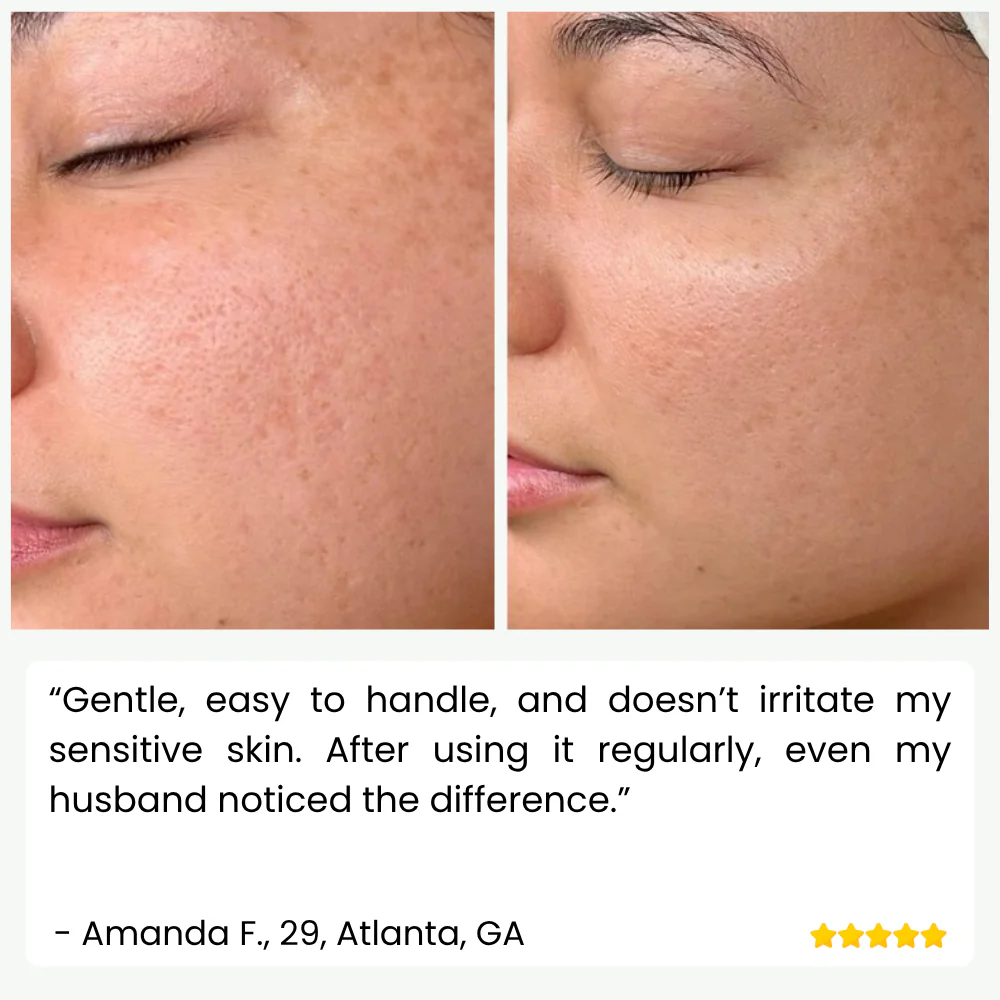 SkinPulse™ - Professional Ultrasonic Skin Cleansing - Image 8