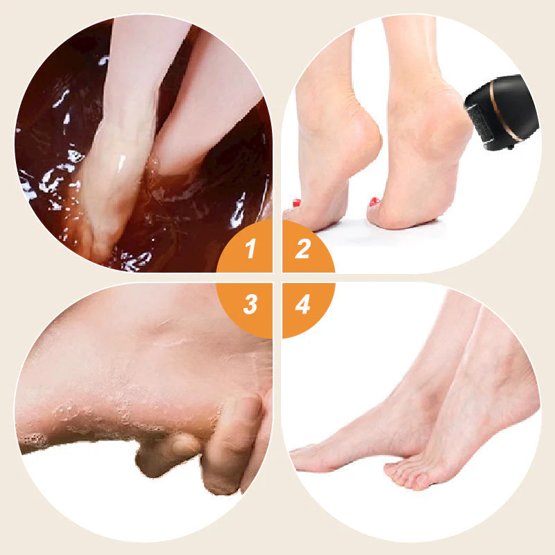SoleRadiance™ — Transform Rough Feet into Silky Confidence You’ll Want to Show Off - Image 7