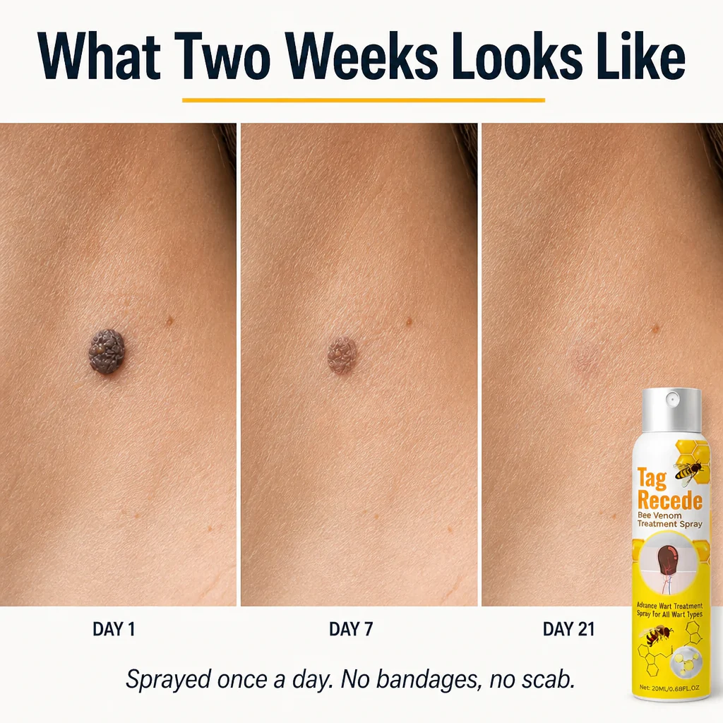VenomaSilk™ — Spray Stubborn Warts Away Painlessly with Bee Venom and Salicylic Acid - Image 3